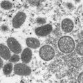 サル痘、世界で７８０件確認　「ウイルス拡大の恐れも」―ＷＨＯ