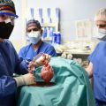 ブタの心臓を人体に移植　米で世界初の成功