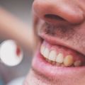 「鼻の穴の中に歯が生える」という超珍しい例が報告される